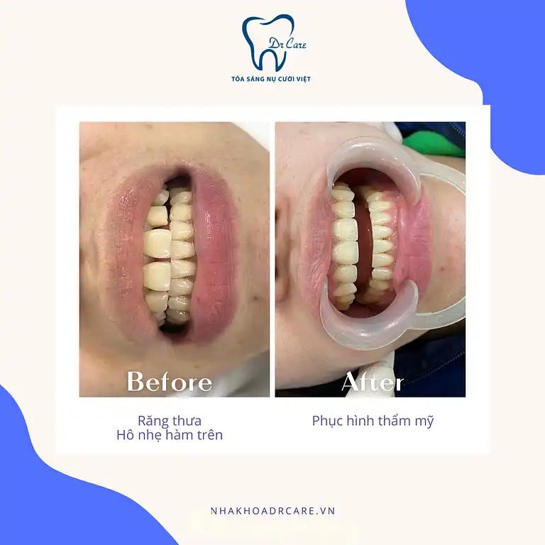 Hình ảnh Nha Khoa Dr Care: 169 Bình Lộc, TP Hải Dương