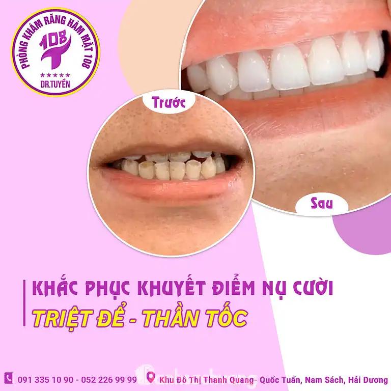 Hình ảnh Nha Khoa 108: QL37, chợ Rồng, Thanh Quang, Nam Sách, Hải Dương