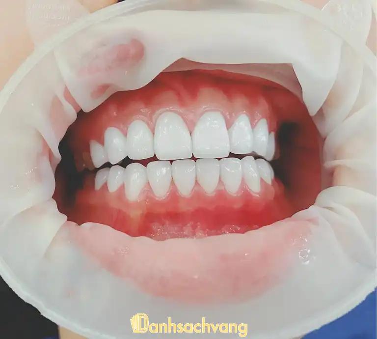 Hình ảnh Nha Khoa Việt Thăng Smile