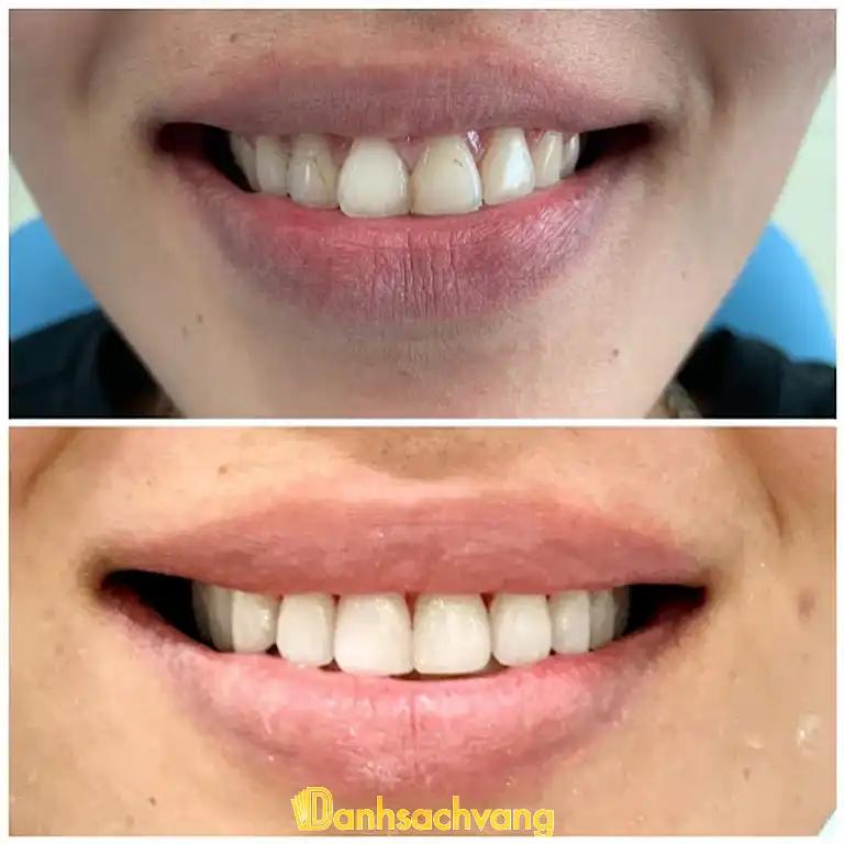 Hình ảnh Nha Khoa Bảo Ngọc