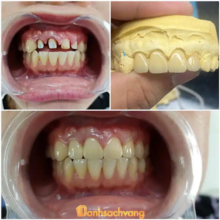 Hình ảnh Nha Khoa Bảo Ngọc
