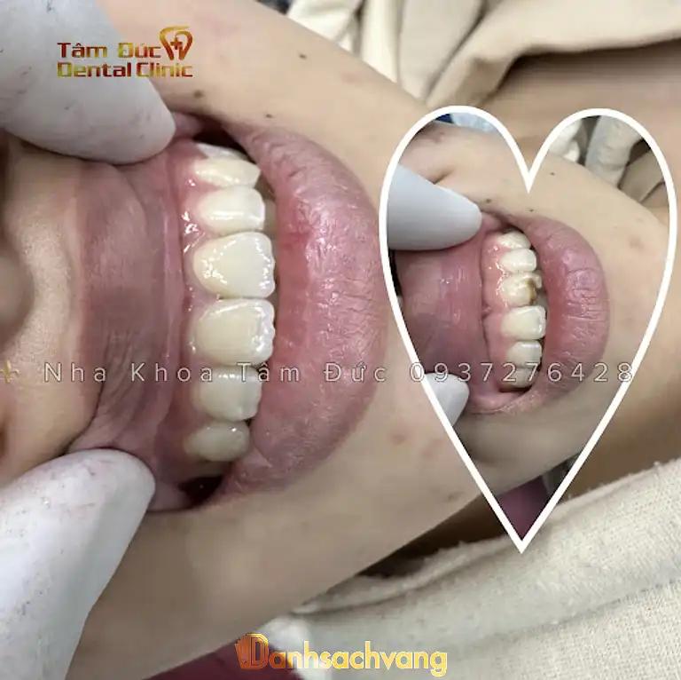Hình ảnh Nha Khoa Tâm Đức