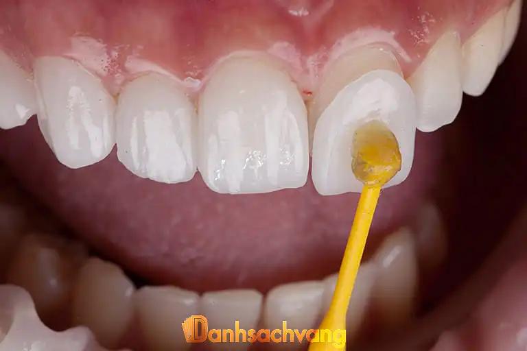 Hình ảnh Nha Khoa Cần Đước