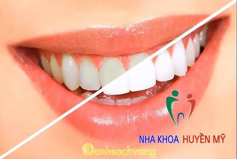 Hình ảnh Nha Khoa Huyền Mỹ 4