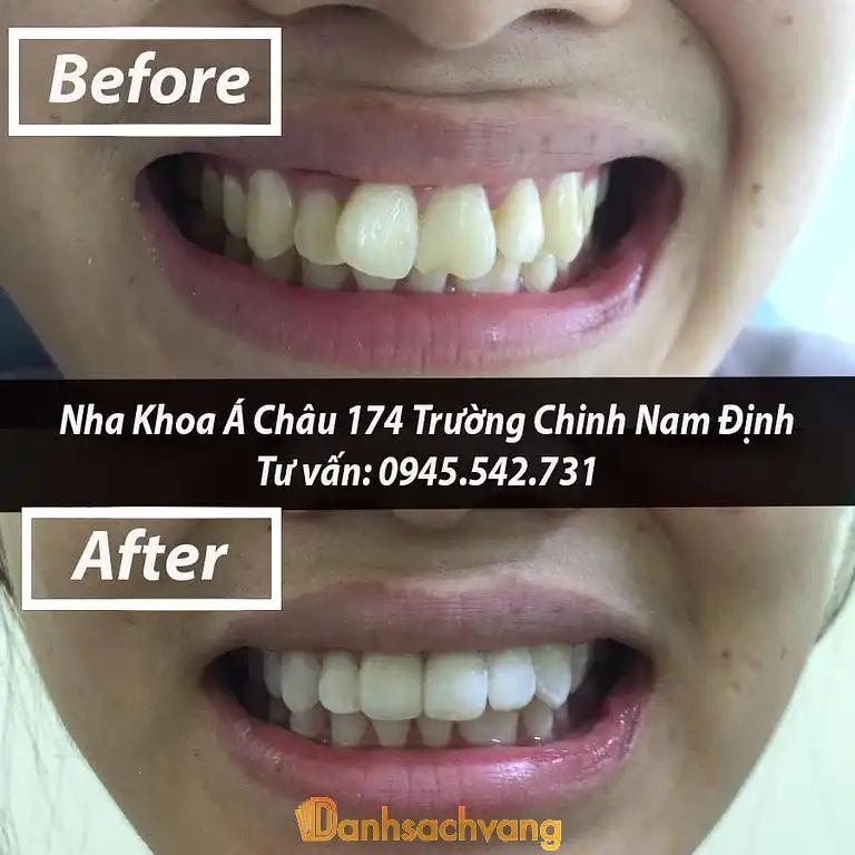 Hình ảnh Nha khoa Á Châu: 174 Trường Chinh, Tp Nam Định