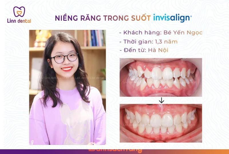 Hình ảnh Nha khoa Linn Dental: số SH6-4, KĐT Times Garden, Tp Hạ Long, Quảng Ninh