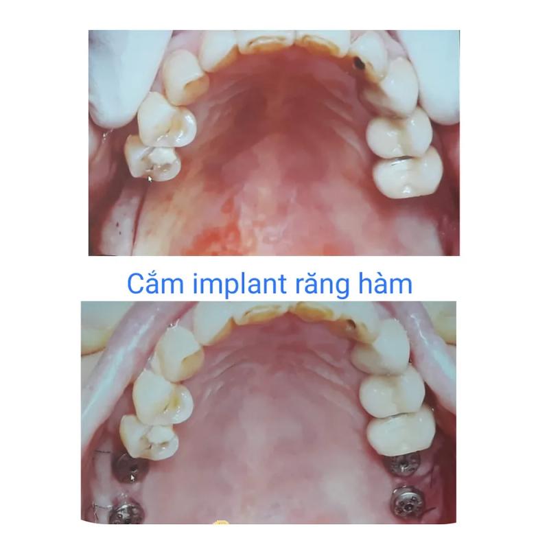 Hình ảnh Nha Khoa 558 dr Hân: 558 Bà Triệu, Tp Thanh Hóa