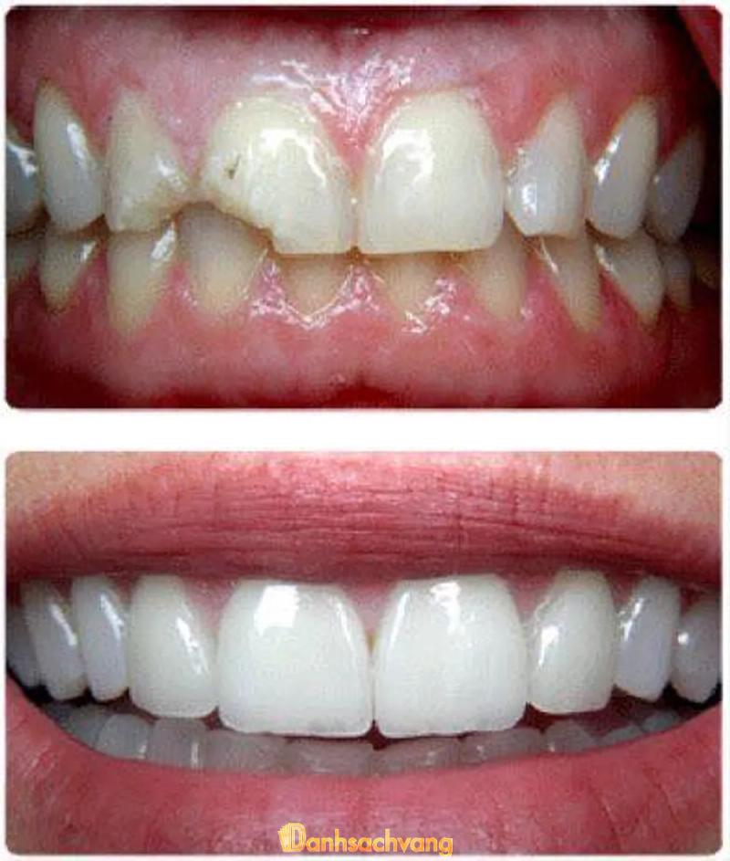 Hình ảnh Nha Khoa Hiền Hòa: Ấp 3 Hùng Vương, H. Nhơn Trạch