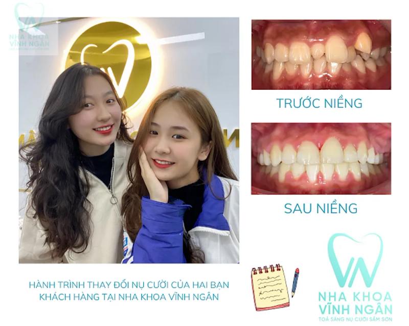 Hình ảnh Nha khoa Vĩnh Ngân: 65 Tây Sơn, Tp Sầm Sơn, Thanh Hoá