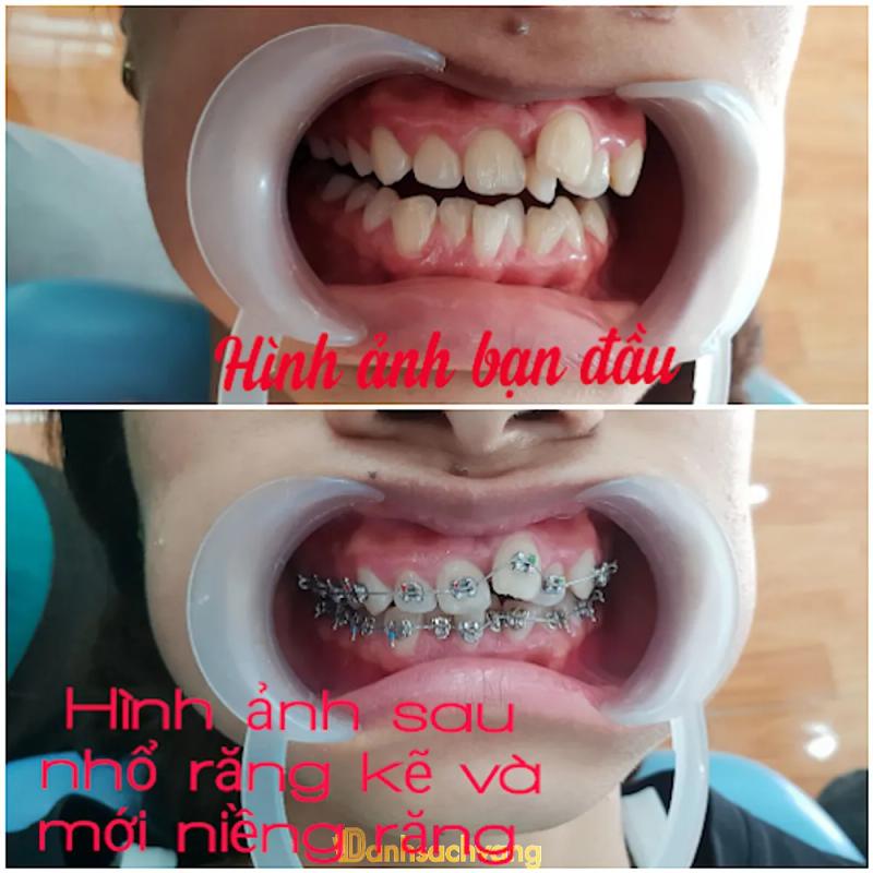 Hình ảnh Nha khoa QT Việt - Sing: 211 ĐT305, TT. Yên Lạc, Vĩnh Phúc