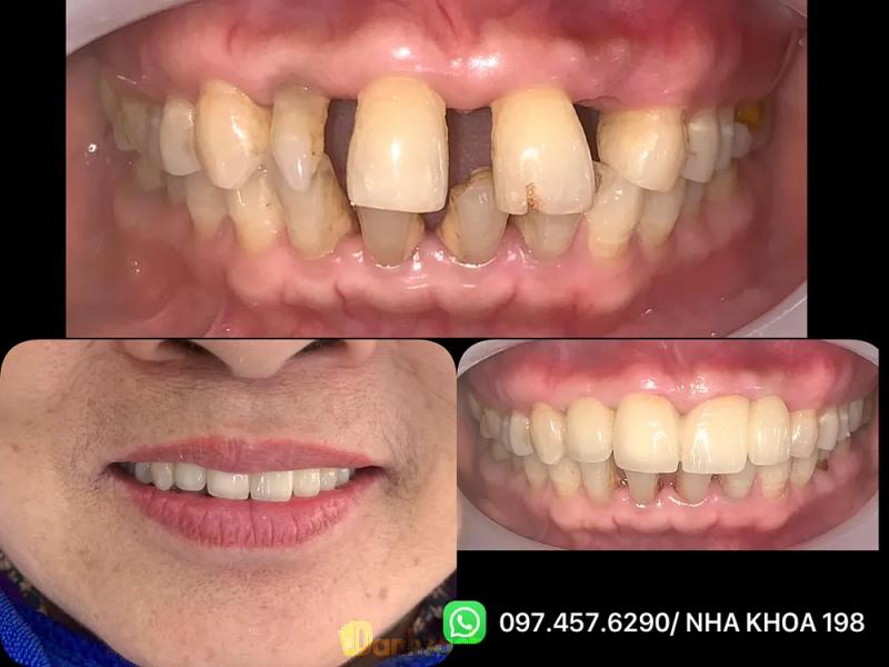 Hình ảnh Nha Khoa 198: ngã 3 Tiên Cầu, Hiệp Cầu, Kim Động, Hưng Yên