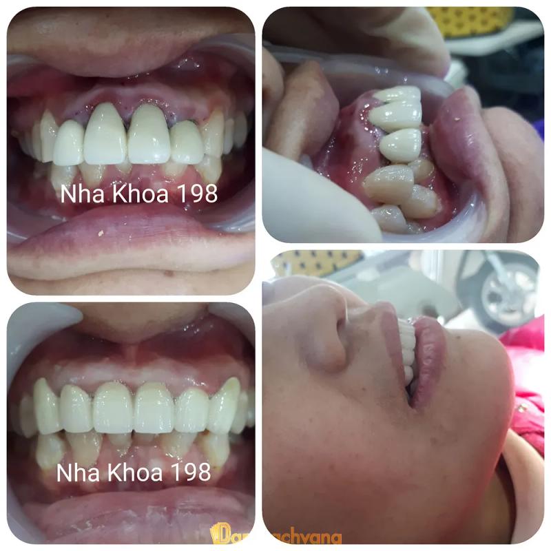 Hình ảnh Nha Khoa 198: ngã 3 Tiên Cầu, Hiệp Cầu, Kim Động, Hưng Yên