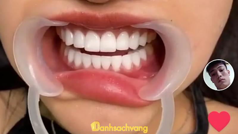 Hình ảnh nha-khoa-anh-sang-2-830a-binh-gia-tp-vung-tau004