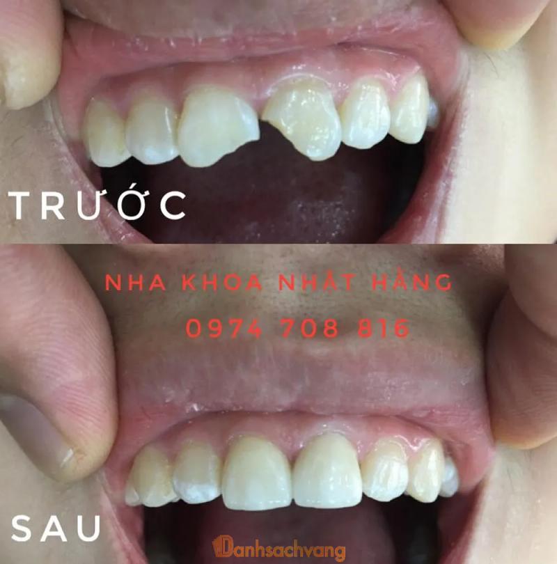 Hình ảnh Nha khoa Nhật Hằng (Bs Quân): đường Cao Bằng, Tx. Phú Thọ
