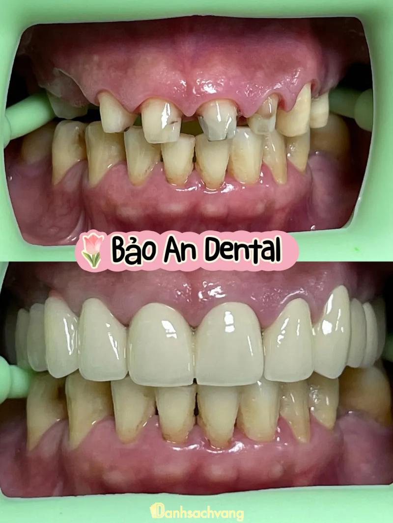 Hình ảnh Nha Khoa BẢO AN: 73 Trung Tín, H. Xuân Lộc