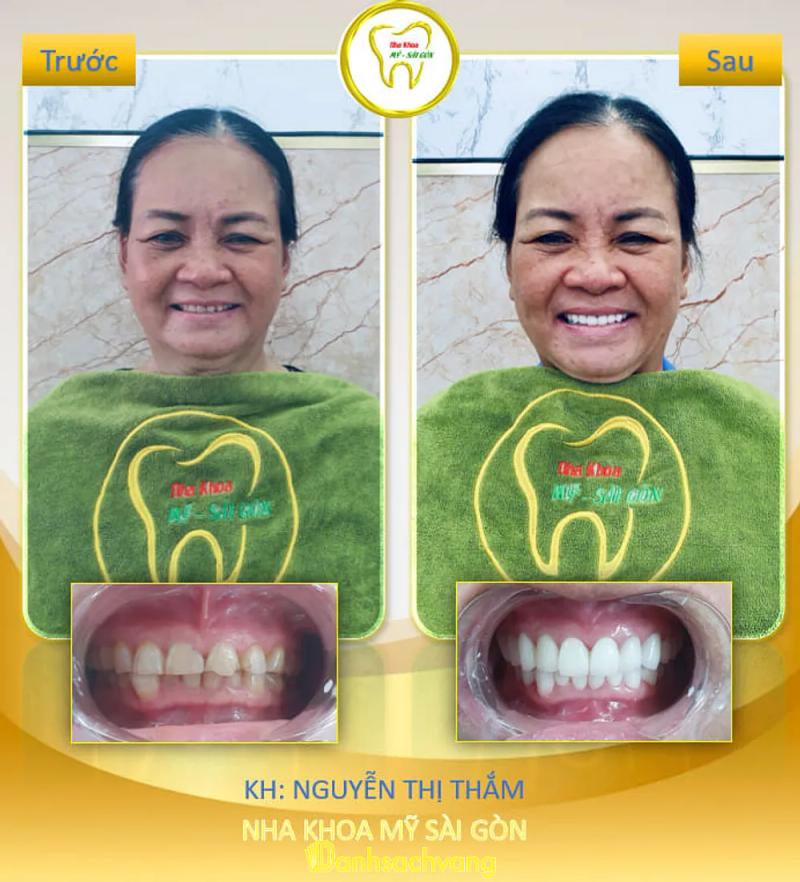 Hình ảnh Nha Khoa MỸ SÀI GÒN - Xuân Lộc: 3162 QL1A, H.Xuân Lộc