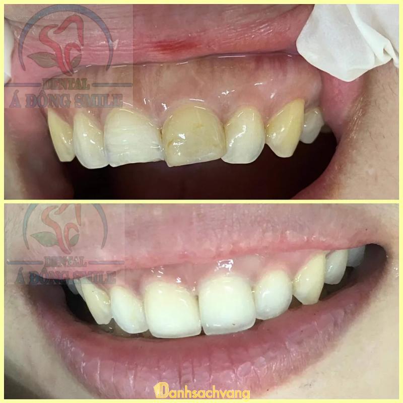 Hình ảnh Nha khoa Á Đông Smile:  2121 QL1A,  H.Xuân Lộc