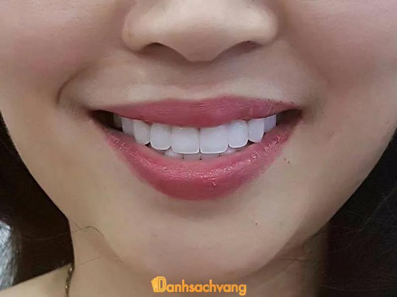 Hình ảnh Nha khoa Hồ Bích: 844 Cù Chính Lan, Tp Hòa Bình