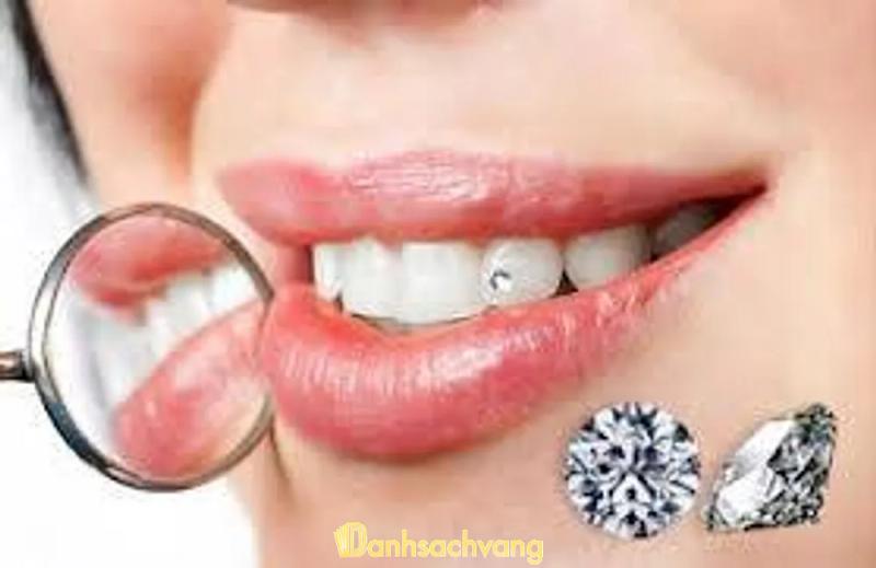 Hình ảnh Nha khoa Hà Nội: đường Trương Hán Siêu, Tân Thịnh, Tp Hòa Bình