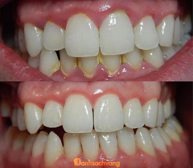 Hình ảnh Nha khoa Cường Nha:  Chợ Suối Nhát, H.Cẩm Mỹ