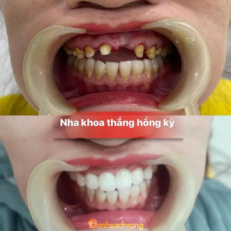 Hình ảnh Nha khoa Thắng Hồng Kỳ: 11b Hà Huy Tập, Tp Vinh, Nghệ An