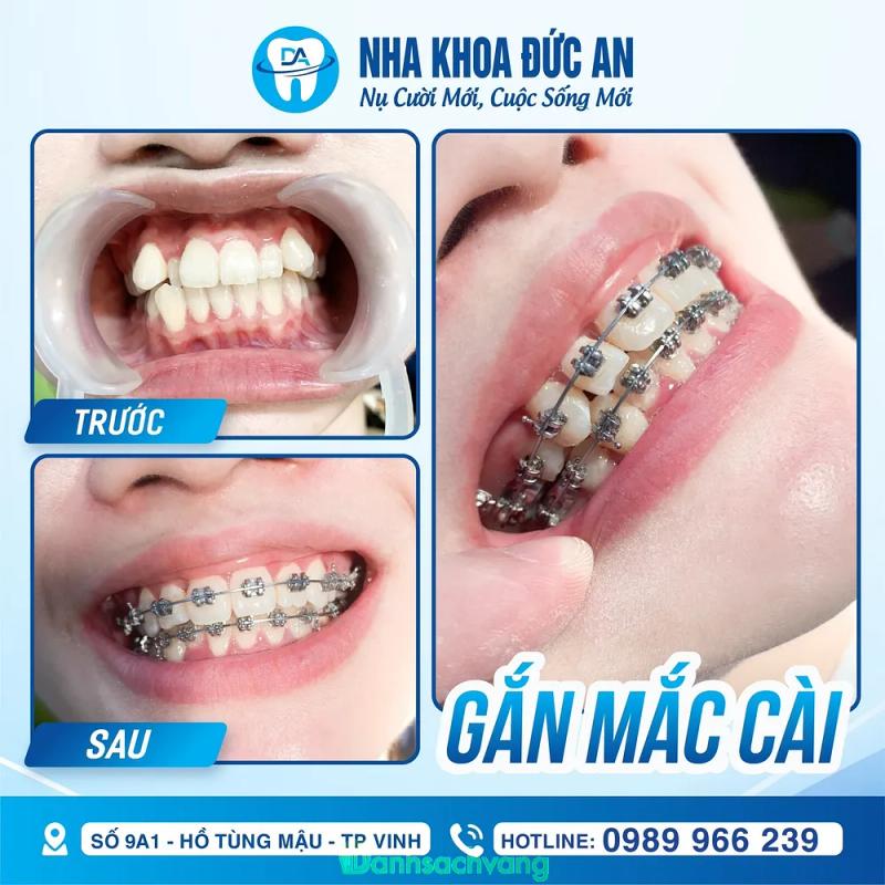 Hình ảnh Nha khoa Đức An: 9A1 Hồ Tùng Mậu, Tp Vinh, Nghệ An