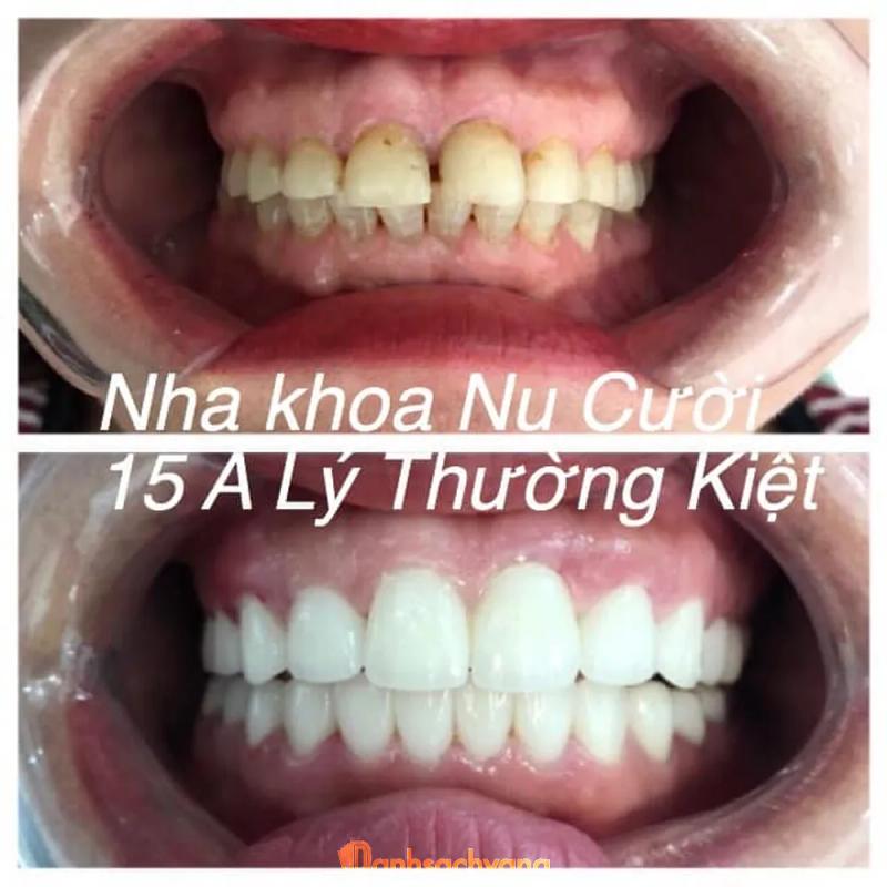 Hình ảnh Nha khoa Nụ Cười: 15 Lý Thường Kiệt, Tp Vinh, Nghệ An