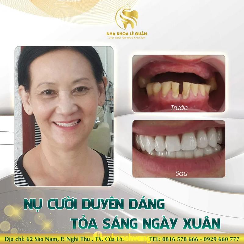 Hình ảnh Nha khoa Lê Quân: 62 Sào Nam, Tx. Cửa Lò, Nghệ An