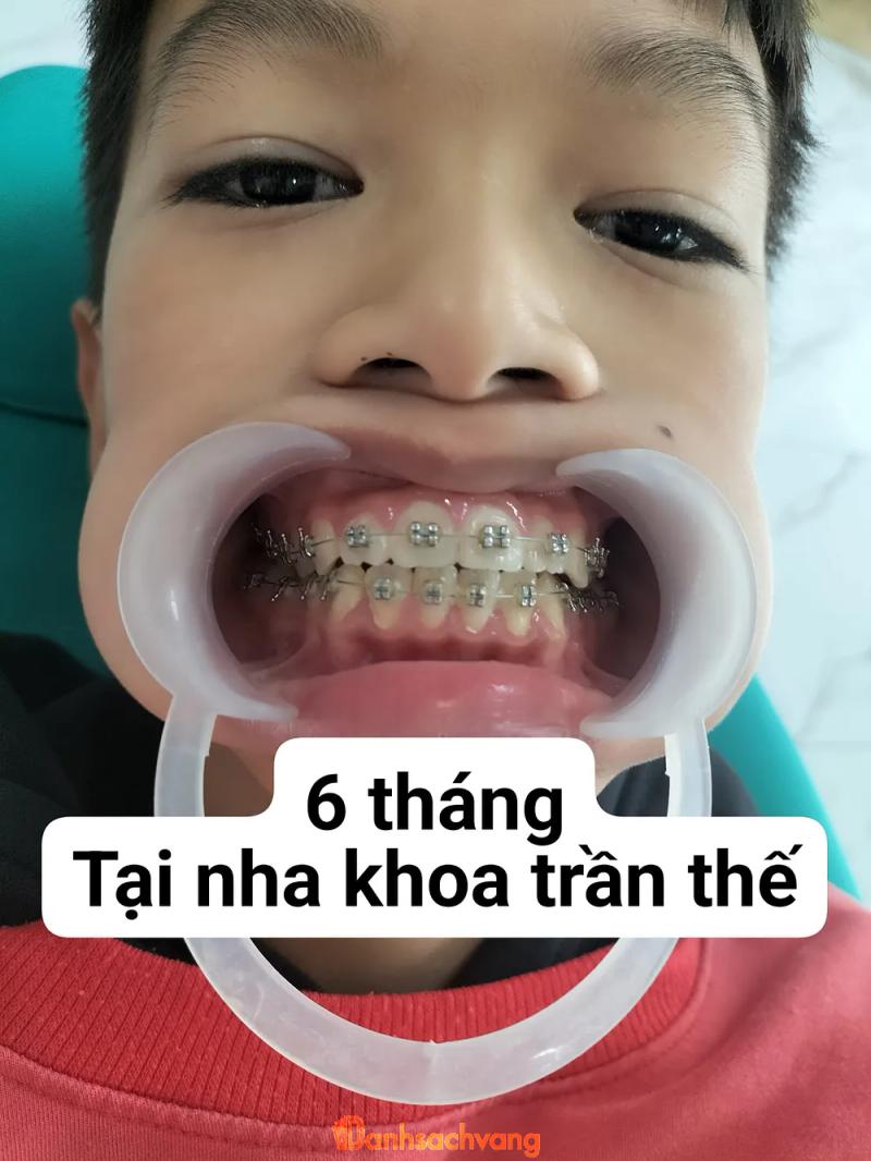 Hình ảnh Nha khoa Trần Thế: QL48A, Quỳnh Châu, Quỳnh Lưu, Nghệ An