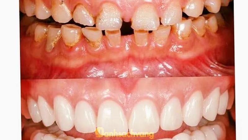 Hình ảnh Nha Khoa Hạnh Phúc: KP8,TT. Vĩnh An, Vĩnh Cửu
