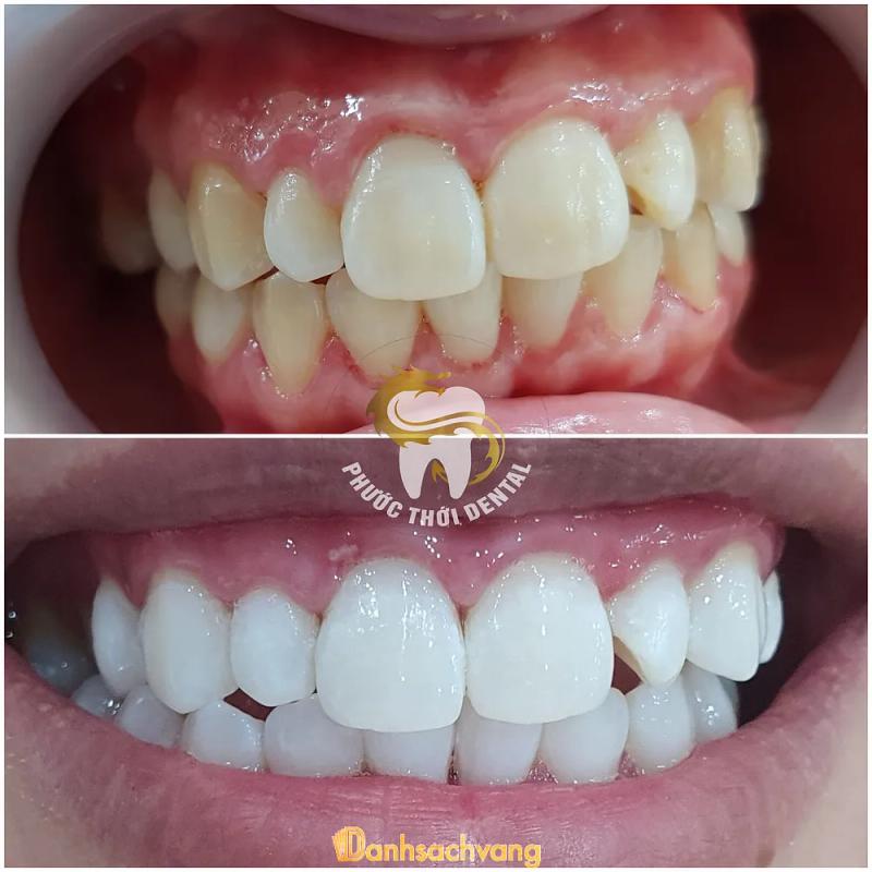 Hình ảnh nha khoa phước thới
