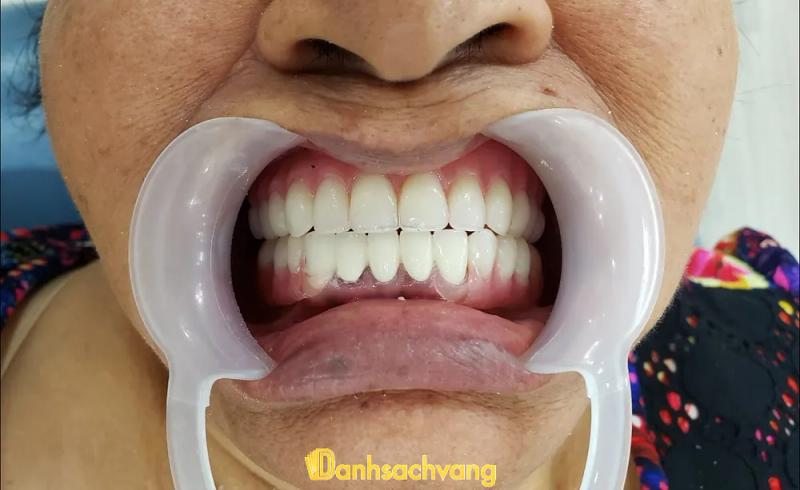 Hình ảnh nha khoa thiện đức 6
