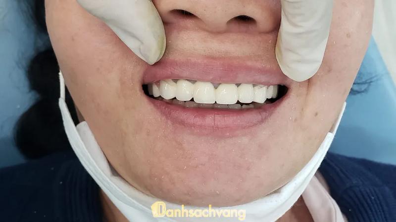 Hình ảnh nha khoa thiện đức 6