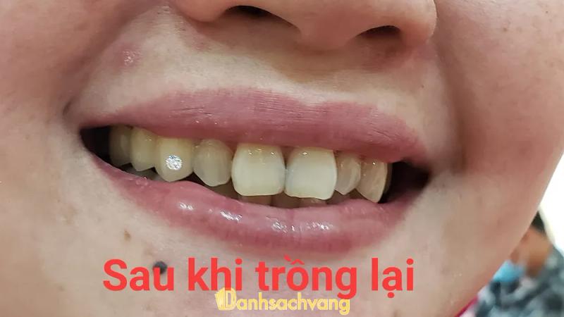Hình ảnh nha khoa thiện đức 6