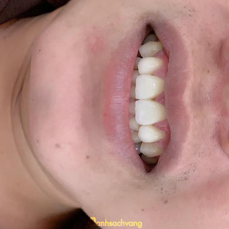Hình ảnh Nha Khoa Việt:  Võ Văn Tần, H.Vĩnh Hưng