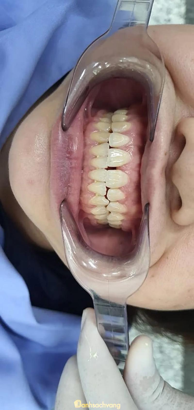 Hình ảnh Nha Khoa Thẩm Mĩ 103: Gia Trấn, H.Gia Viễn