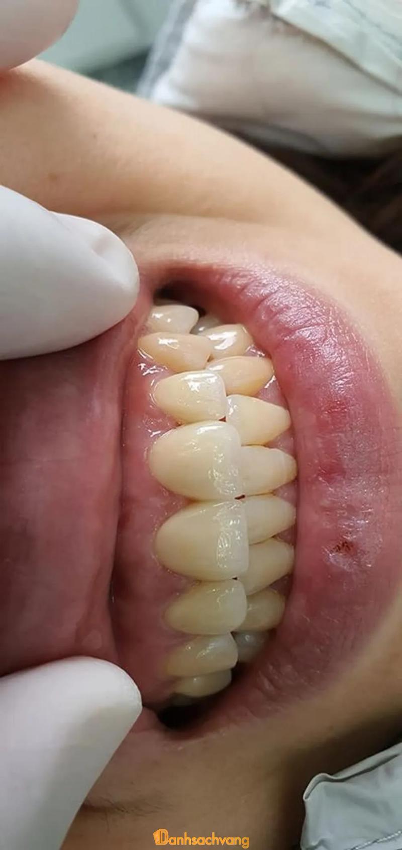 Hình ảnh Nha Khoa Thẩm Mĩ 103: Gia Trấn, H.Gia Viễn