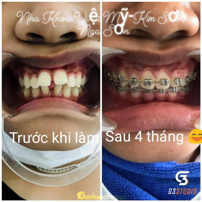 Hình ảnh Nha Khoa Việt Mỹ