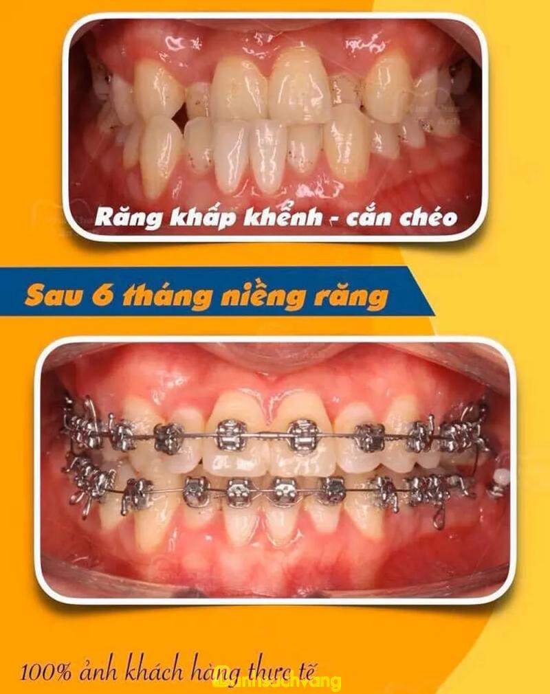 Hình ảnh nha-khoa-viet-my-34-le-quang-dinh-tp-vung-tau-5