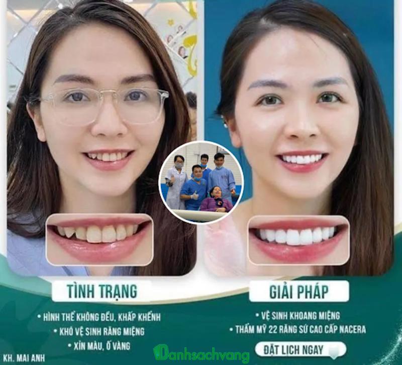 Hình ảnh Nha Khoa Hà Nội