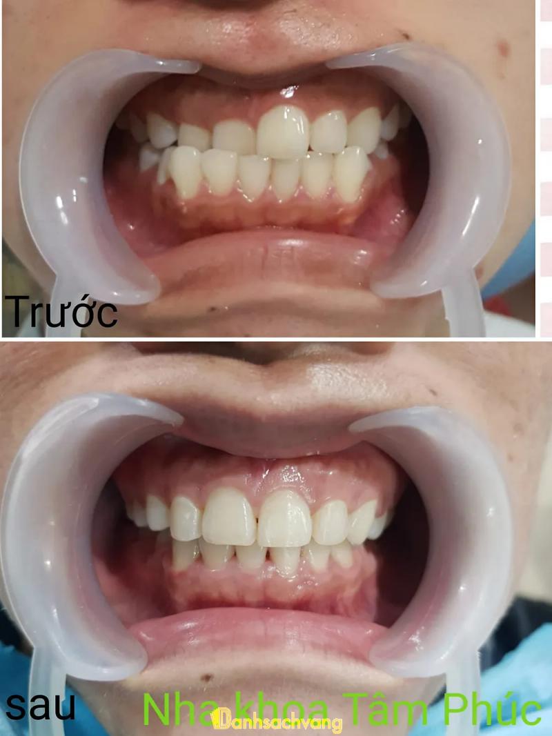 Hình ảnh Nha khoa Tâm Phúc: C1/040 Thanh Sơn, H.Thống Nhất