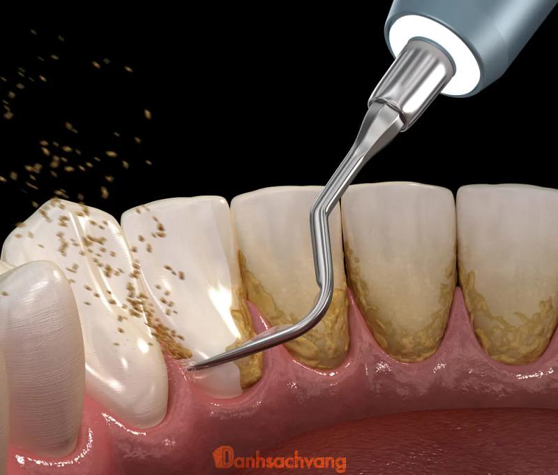 Hình ảnh Nha khoa Tâm Phúc: C1/040 Thanh Sơn, H.Thống Nhất