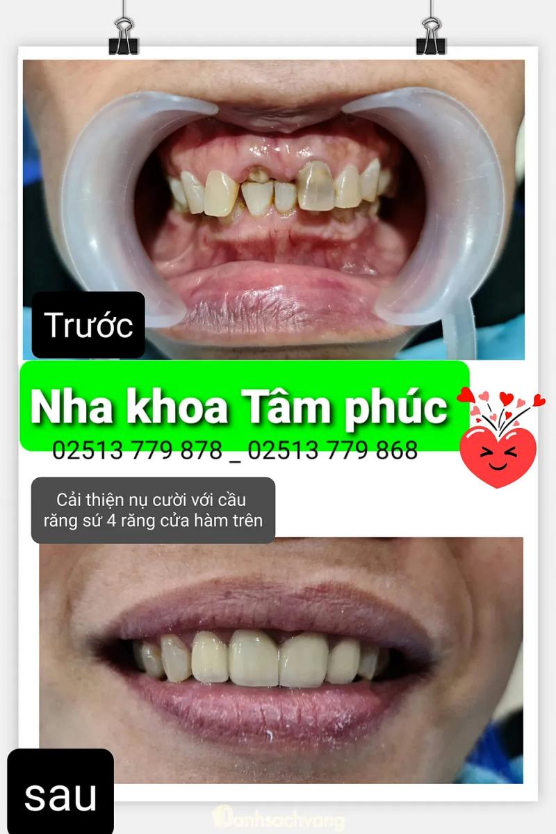 Hình ảnh Nha khoa Tâm Phúc: C1/040 Thanh Sơn, H.Thống Nhất