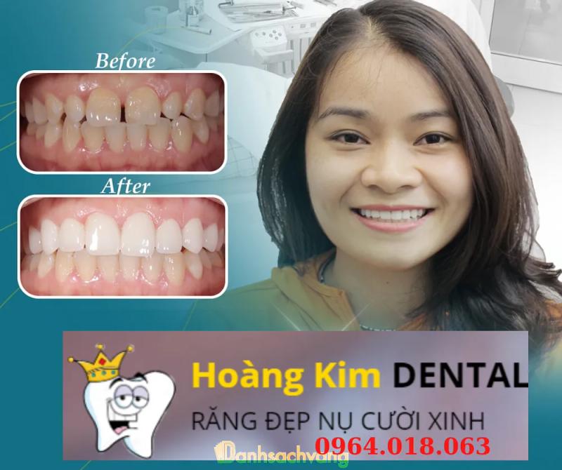 Hình ảnh NHA KHOA HOÀNG KIM: 128/1 Bạch Lâm 1, H.Thống Nhất