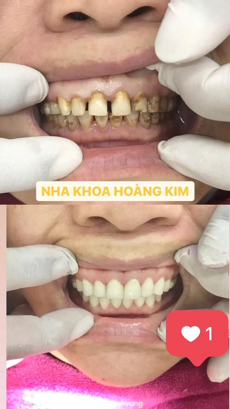 Hình ảnh NHA KHOA HOÀNG KIM: 128/1 Bạch Lâm 1, H.Thống Nhất