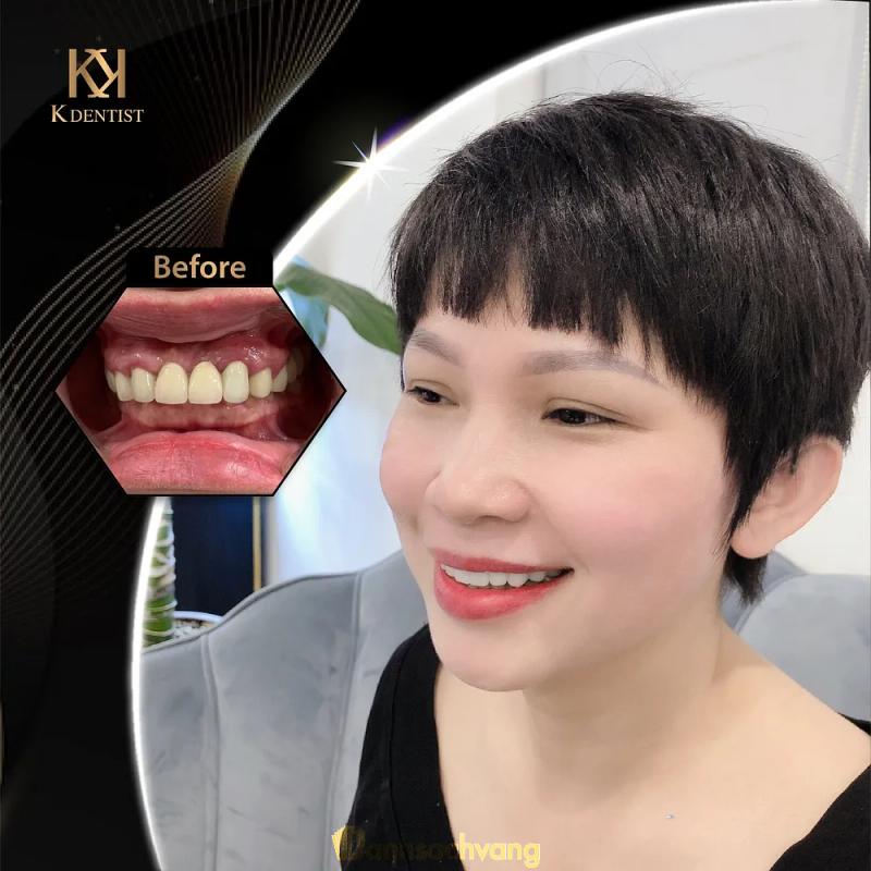 Hình ảnh nha-khoa-k-dentist-463-nguyen-an-ninh-tp-vung-tau-5