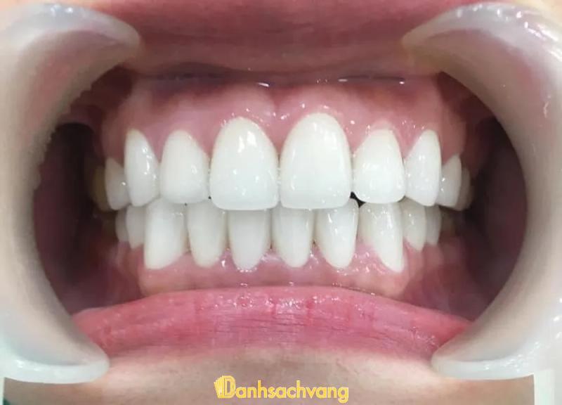 Hình ảnh  Nha Khoa Hoàng Gia: ĐT764, H.Cẩm Mỹ 