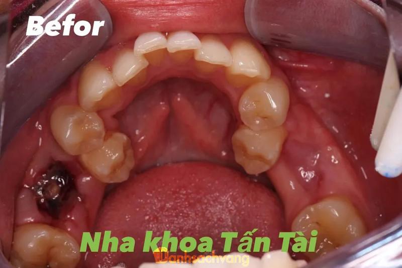 Hình ảnh Nha Khoa Tấn Tài