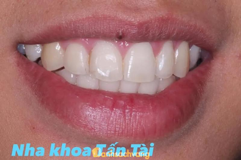 Hình ảnh Nha Khoa Tấn Tài