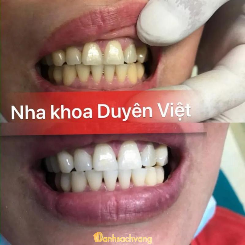 Hình ảnh NHA KHOA DUYÊN VIỆT: 334 Phước Đức, H. Gò Dầu